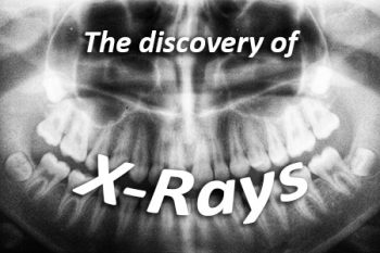 Glencoe dentist, Dr. Shawn Knorr at Forever Smiles discusses the discovery of x-rays and how they have advanced over the years.